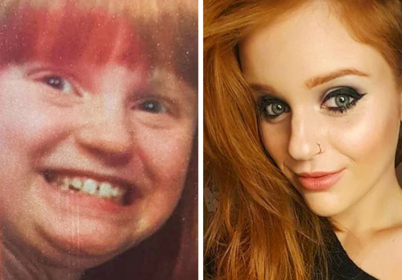 De un patito feo a un cisne hermoso: estos 18 adolescentes demostraron que cualquiera puede convertirse en un hombre guapo De un patito feo a un cisne hermoso: estos 18 adolescentes demostraron que cualquiera puede convertirse en un hombre guapo