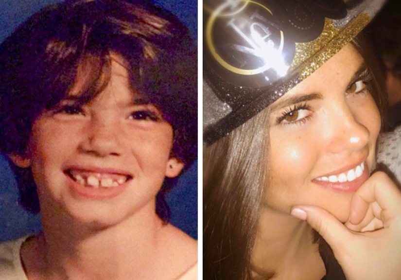 De un patito feo a un cisne hermoso: estos 18 adolescentes demostraron que cualquiera puede convertirse en un hombre guapo De un patito feo a un cisne hermoso: estos 18 adolescentes demostraron que cualquiera puede convertirse en un hombre guapo