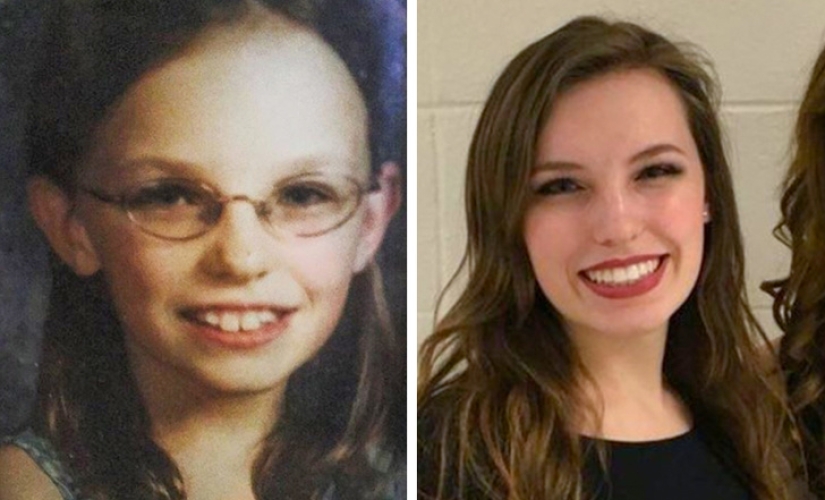 De un patito feo a un cisne hermoso: estos 18 adolescentes demostraron que cualquiera puede convertirse en un hombre guapo De un patito feo a un cisne hermoso: estos 18 adolescentes demostraron que cualquiera puede convertirse en un hombre guapo