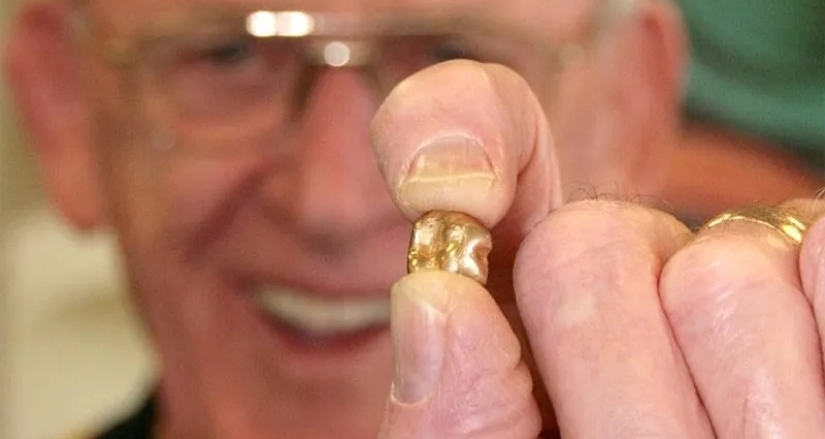 Dead Man's Gold: What happens to gold crowns during cremation Dead Man's Gold: What happens to gold crowns during cremation