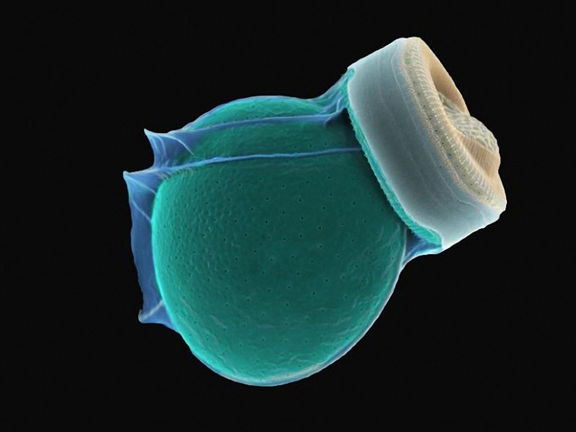 Diatoms: Micrographs by Paul Hargreaves and Fay Darling