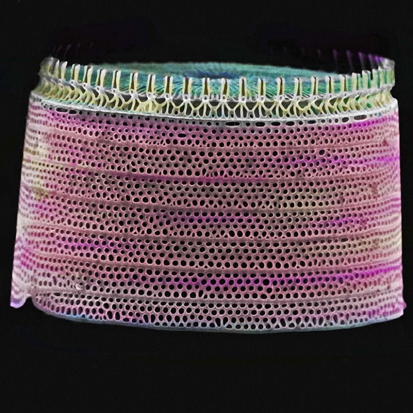 Diatoms: Micrographs by Paul Hargreaves and Fay Darling