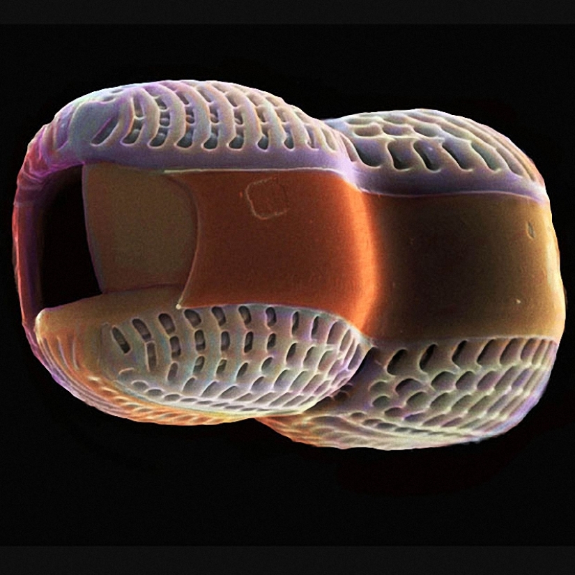 Diatoms: Micrographs by Paul Hargreaves and Fay Darling