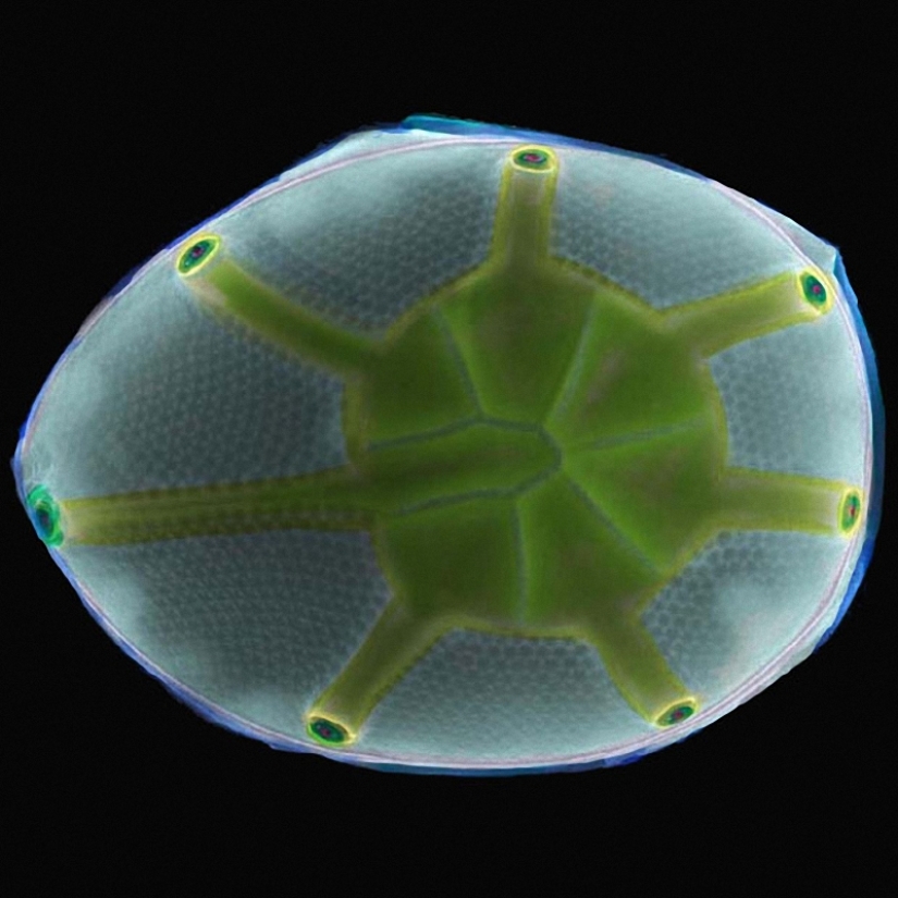 Diatoms: Micrographs by Paul Hargreaves and Fay Darling