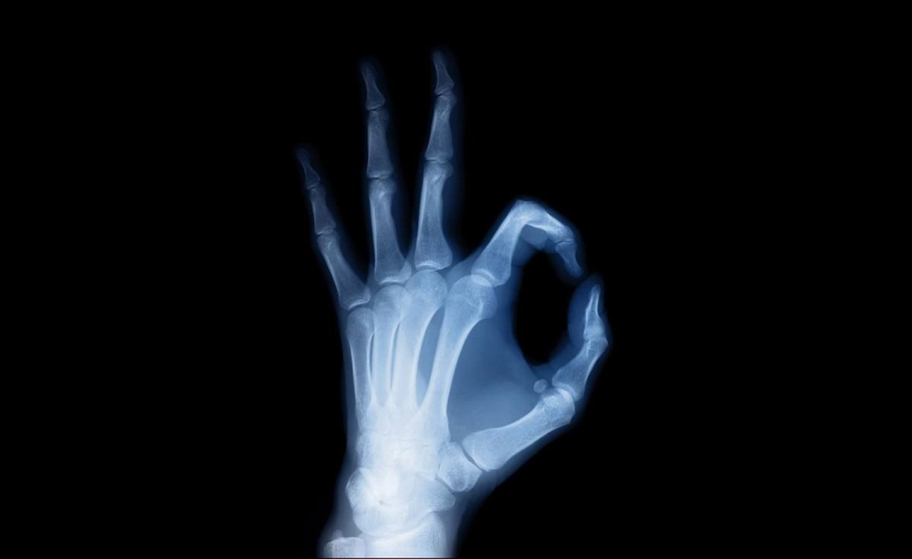 Diez descubrimientos científicos que sucedieron por accidente Diez descubrimientos científicos que sucedieron por accidente