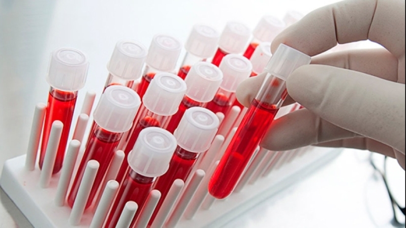 Donde cada uno de nosotros está esperando la hipoxia y cómo lidiar con ella Donde cada uno de nosotros está esperando la hipoxia y cómo lidiar con ella