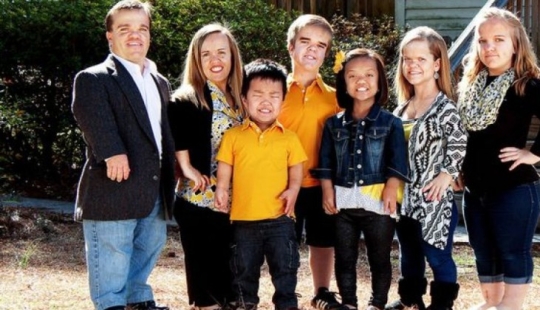 Dwarfs and midgets: how different are these little people