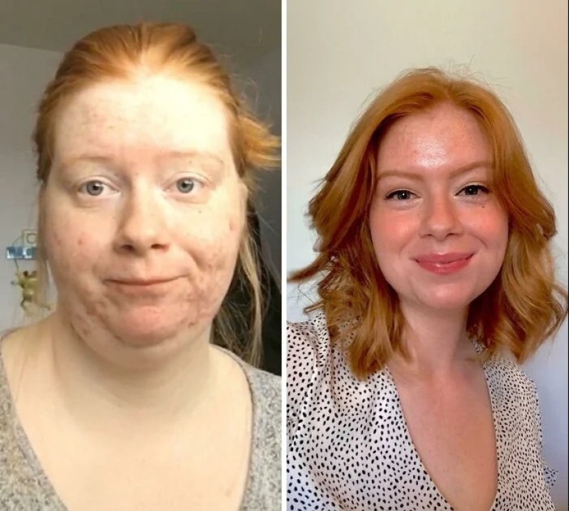 Ejemplos inspiradores de transformación cardinal: 30 fotos antes y después de la pérdida de peso