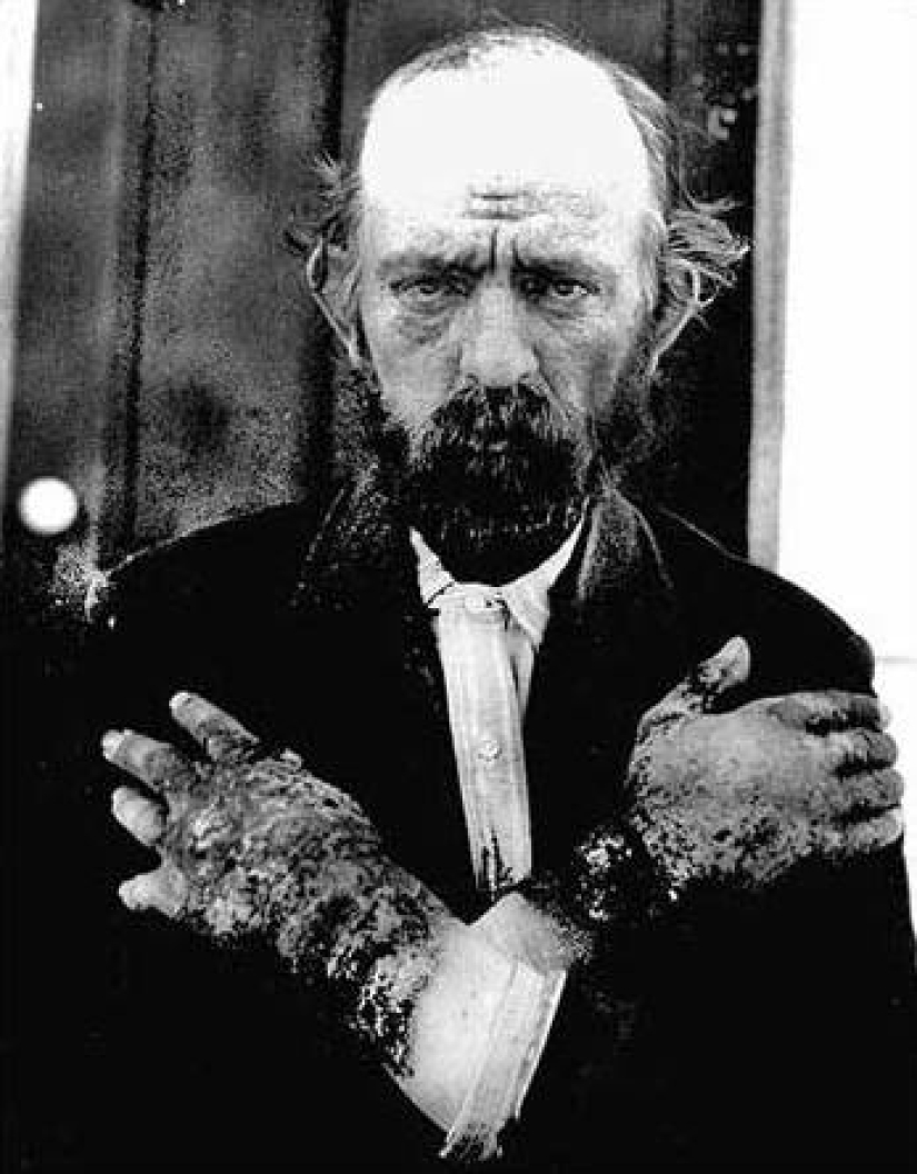 El espíritu maligno del maíz: cómo una antigua maldición indígena continúa matando a los europeos