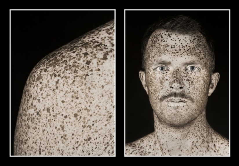 El fotógrafo mostró cuánto cambia la piel el sol. ¡Después de eso, dejarás de amar el bronceado! El fotógrafo mostró cuánto cambia la piel el sol. ¡Después de eso, dejarás de amar el bronceado!