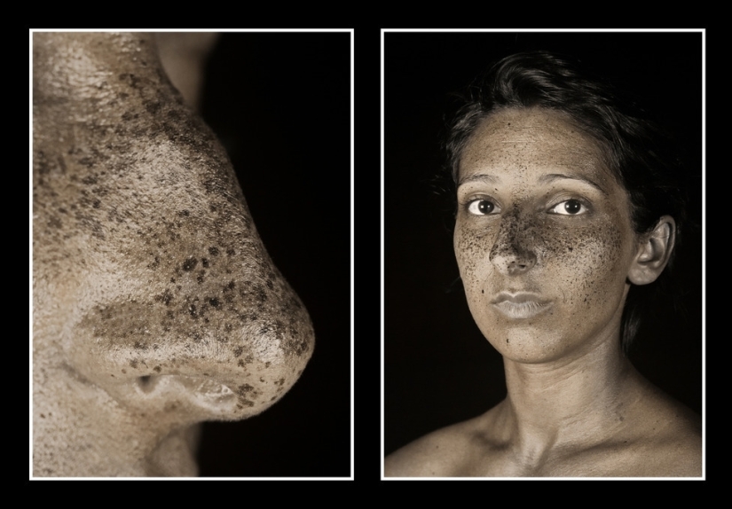 El fotógrafo mostró cuánto cambia la piel el sol. ¡Después de eso, dejarás de amar el bronceado! El fotógrafo mostró cuánto cambia la piel el sol. ¡Después de eso, dejarás de amar el bronceado!