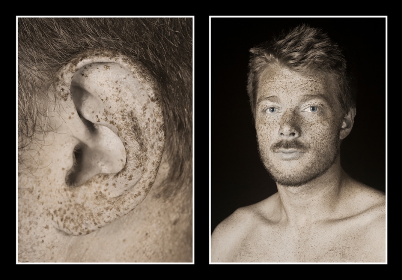 El fotógrafo mostró cuánto cambia la piel el sol. ¡Después de eso, dejarás de amar el bronceado! El fotógrafo mostró cuánto cambia la piel el sol. ¡Después de eso, dejarás de amar el bronceado!