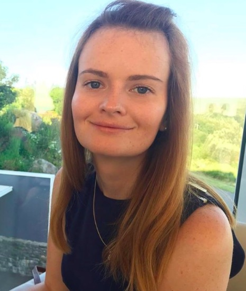 El fotógrafo mostró cuánto cambia la piel el sol. ¡Después de eso, dejarás de amar el bronceado! El fotógrafo mostró cuánto cambia la piel el sol. ¡Después de eso, dejarás de amar el bronceado!