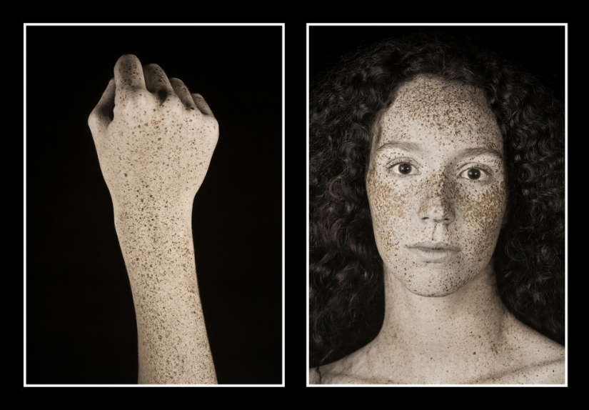 El fotógrafo mostró cuánto cambia la piel el sol. ¡Después de eso, dejarás de amar el bronceado! El fotógrafo mostró cuánto cambia la piel el sol. ¡Después de eso, dejarás de amar el bronceado!