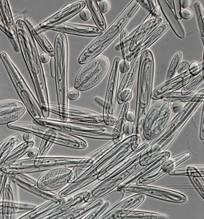 El toque de la mano de la muerte", o por Qué se bañan en pantimedias en el norte de Australia El toque de la mano de la muerte", o por Qué se bañan en pantimedias en el norte de Australia