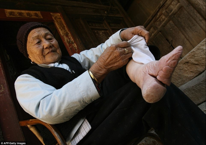 En el pueblo de "Bound Feet" viven las últimas mujeres chinas que sufren de una antigua tradición cruel En el pueblo de "Bound Feet" viven las últimas mujeres chinas que sufren de una antigua tradición cruel
