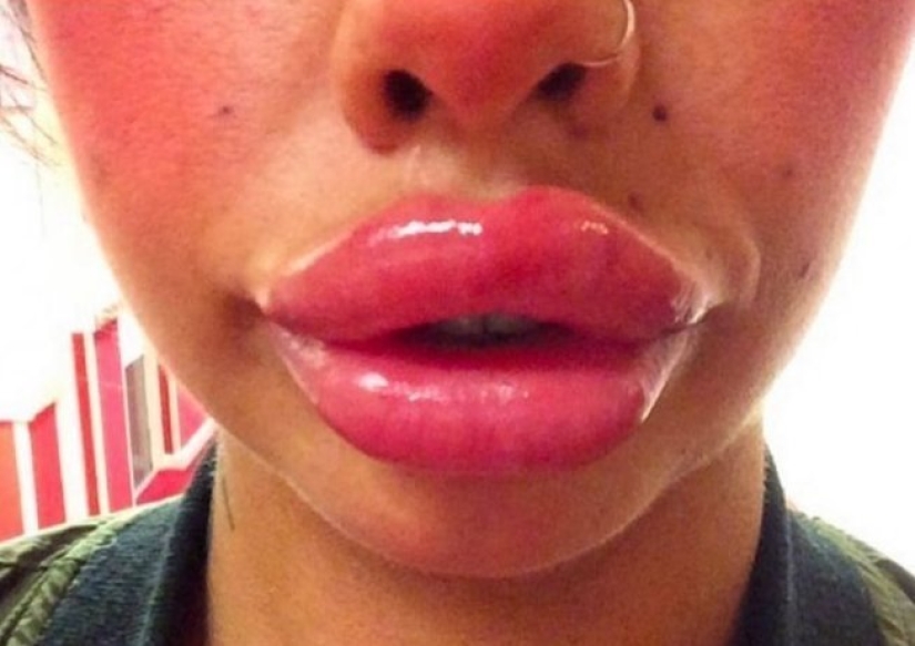 Fashion trends that have long looked ridiculous Fashion trends that have long looked ridiculous