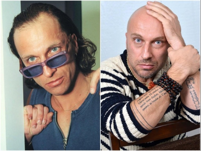 Former density: what did the star actors look like before they shone with a bald head Former density: what did the star actors look like before they shone with a bald head