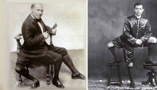 Francesco Lentini - the three-legged "king of freaks" who conquered America