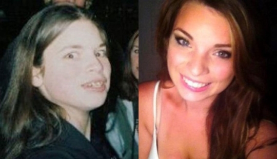 From an ugly duckling to a beautiful swan: these 18 teenagers proved that anyone can become a handsome man From an ugly duckling to a beautiful swan: these 18 teenagers proved that anyone can become a handsome man