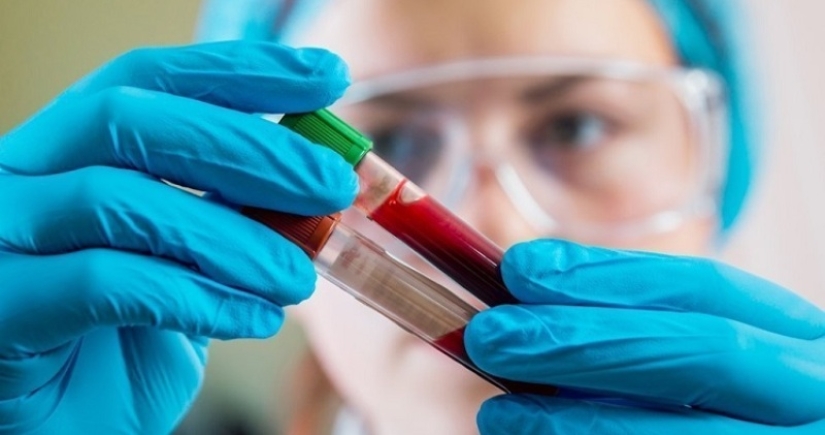 "Golden blood" with a zero Rh factor — why it is both salutary and dangerous at once