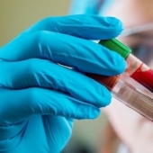 "Golden blood" with a zero Rh factor — why it is both salutary and dangerous at once