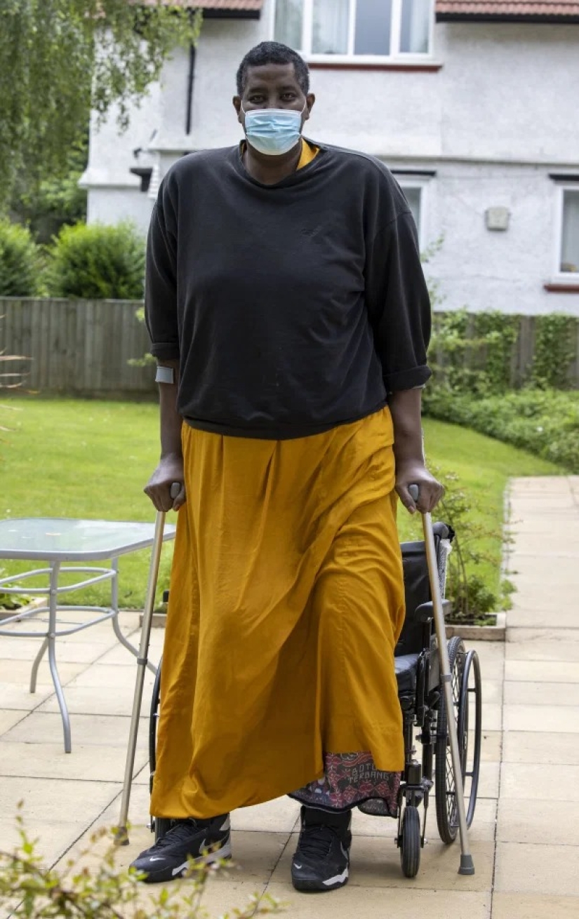 Gran crecimiento-grandes dificultades: cómo sufre una de las personas más altas del mundo Gran crecimiento-grandes dificultades: cómo sufre una de las personas más altas del mundo