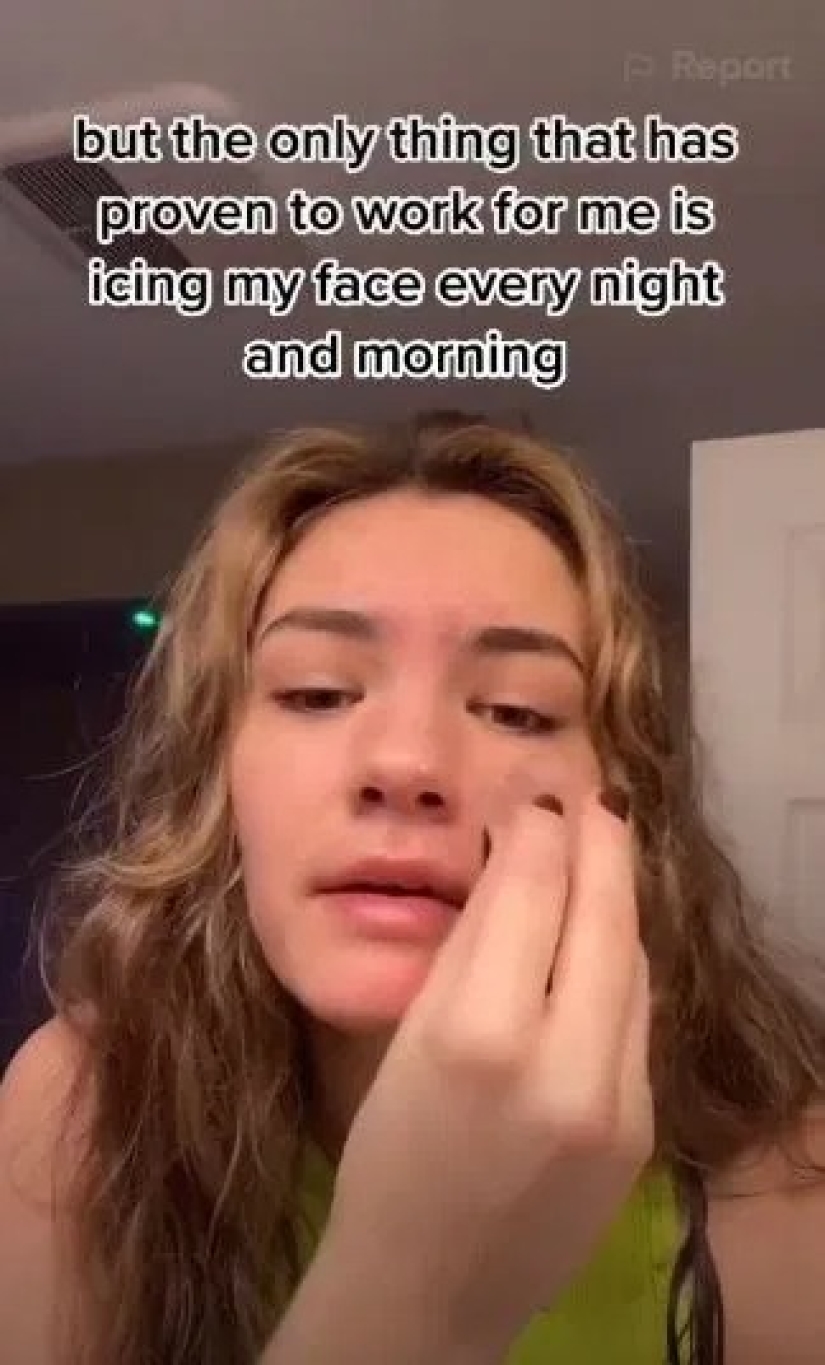 Harmful tips: Popular life hacks from TikTok can ruin your skin