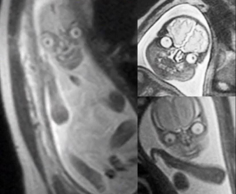 Hasta la piel de gallina: 22 fotos en las que ves algo terrible