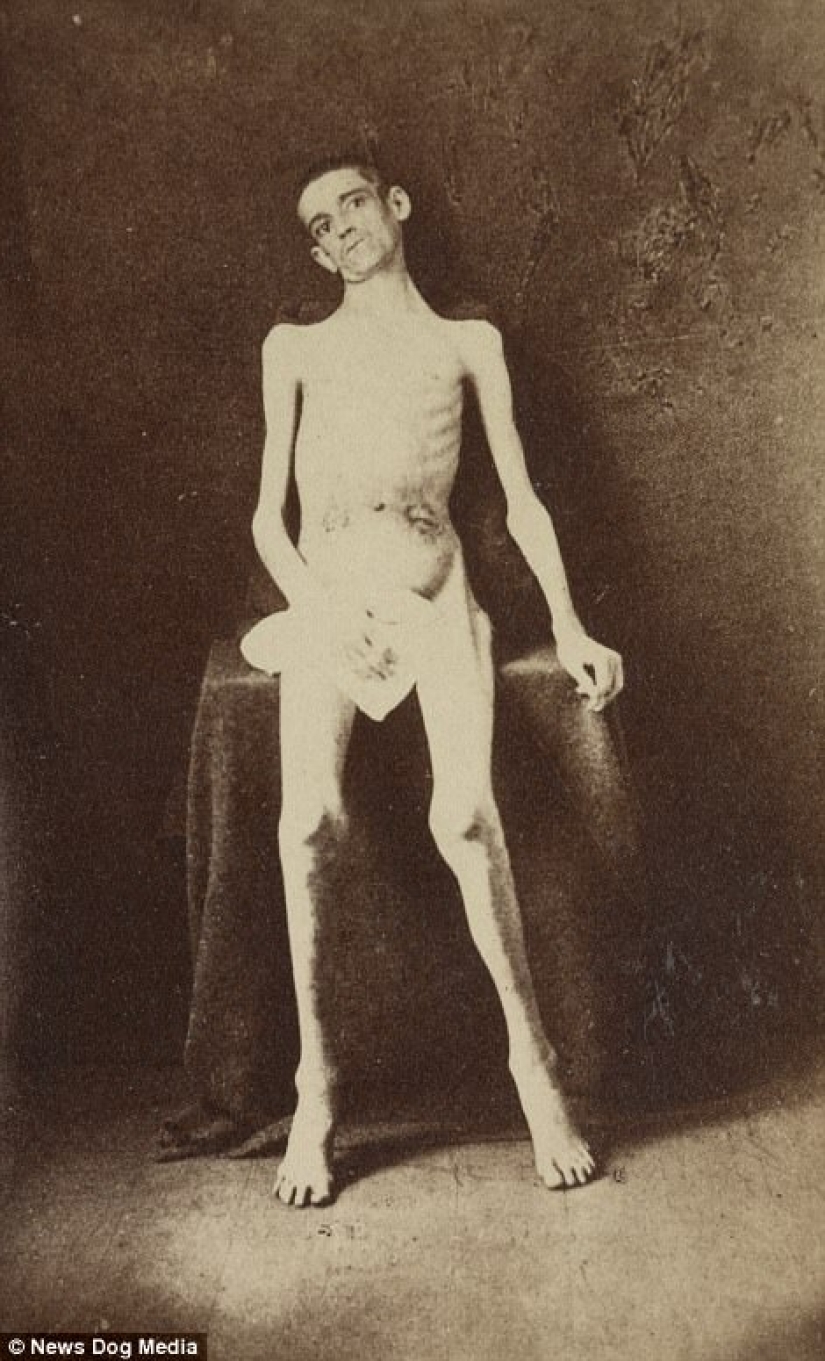 Horribles fotos de víctimas de la guerra más sangrienta de la historia de Estados Unidos Horribles fotos de víctimas de la guerra más sangrienta de la historia de Estados Unidos