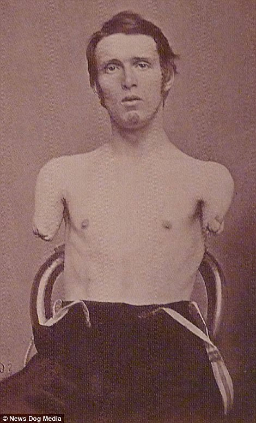 Horribles fotos de víctimas de la guerra más sangrienta de la historia de Estados Unidos Horribles fotos de víctimas de la guerra más sangrienta de la historia de Estados Unidos