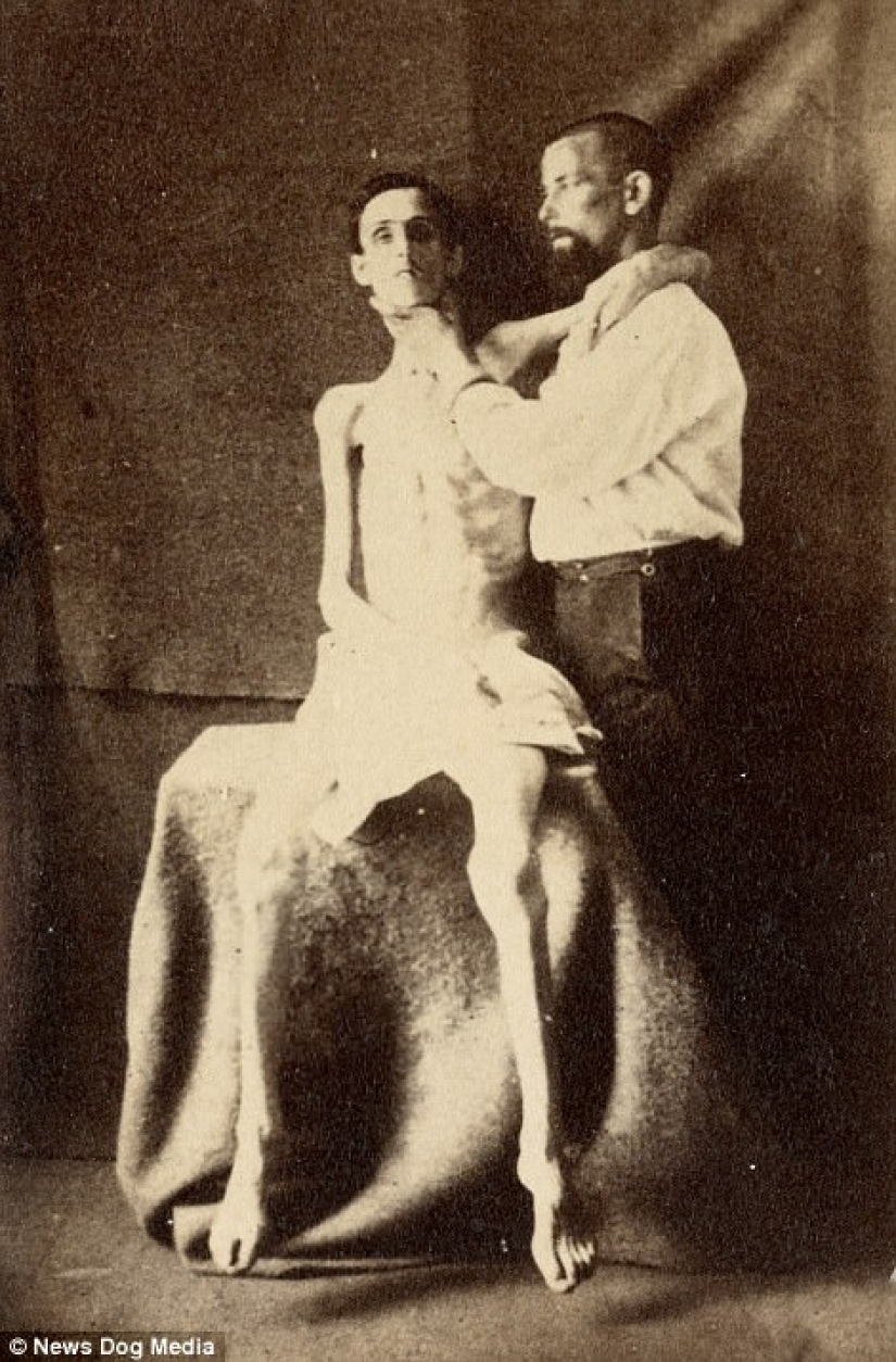 Horrifying photos of victims of the bloodiest war in US history