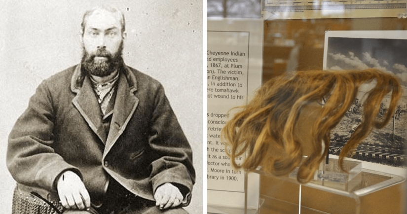 How the Indians scalped an Englishman, and he survived and gave the scalp to the museum: the story of William Thompson How the Indians scalped an Englishman, and he survived and gave the scalp to the museum: the story of William Thompson