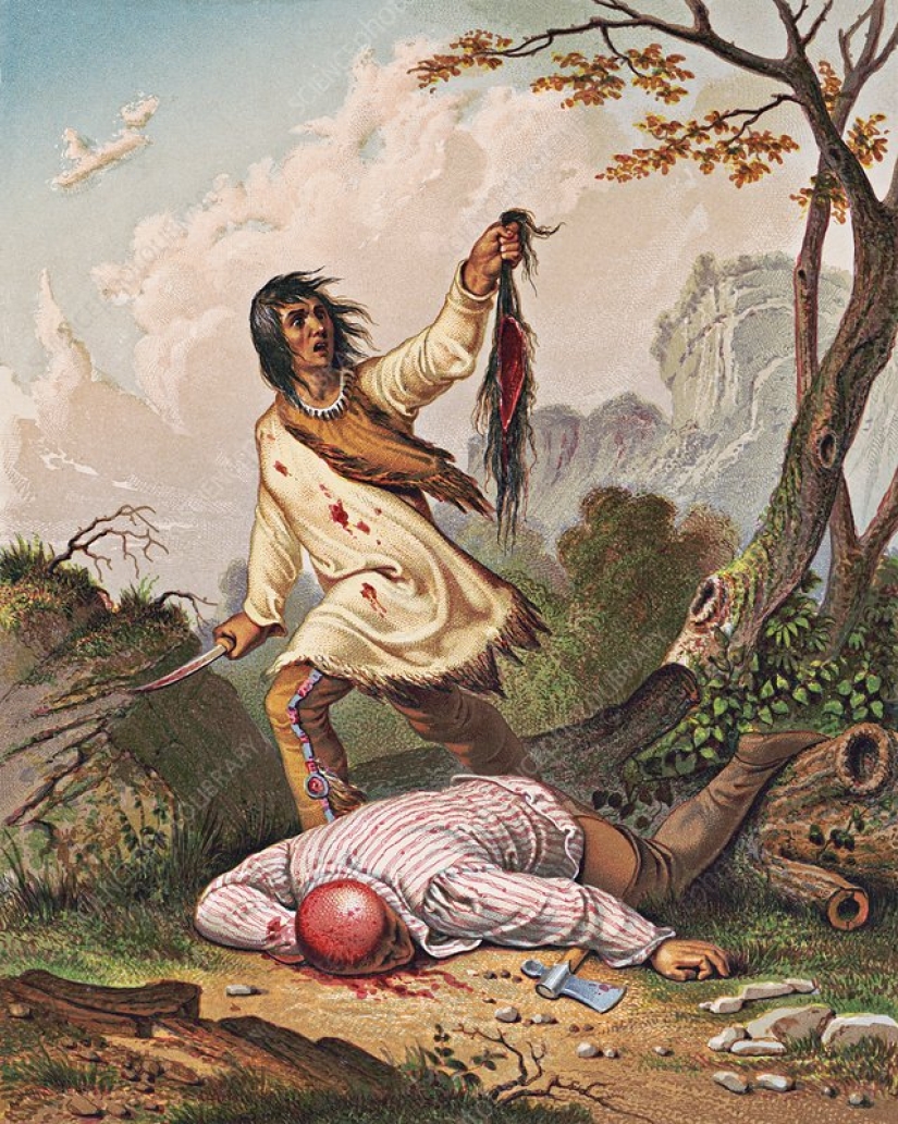 How the Indians scalped an Englishman, and he survived and gave the scalp to the museum: the story of William Thompson How the Indians scalped an Englishman, and he survived and gave the scalp to the museum: the story of William Thompson