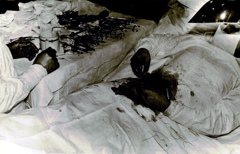 Incredible fortitude and courage: how a Russian doctor operated on himself Incredible fortitude and courage: how a Russian doctor operated on himself