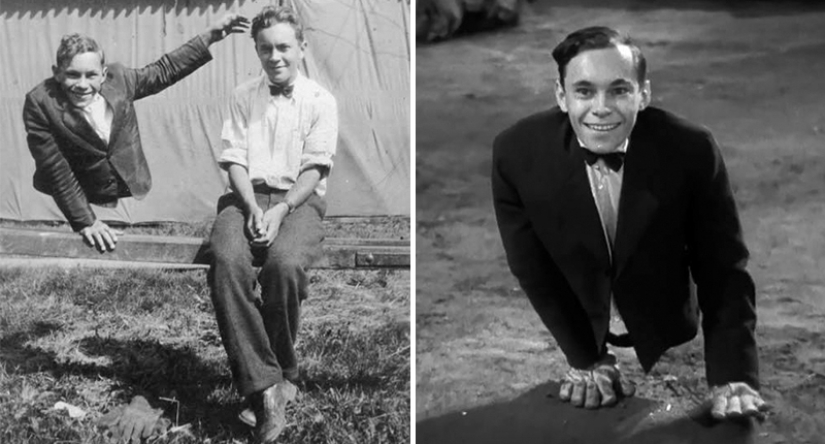 Johnny Eck, el "rey de los freaks" que nació con medio cuerpo