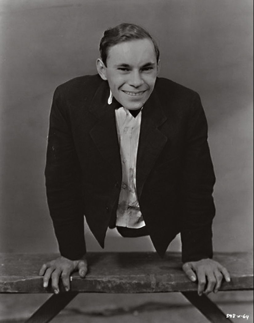 Johnny Eck, el "rey de los freaks" que nació con medio cuerpo