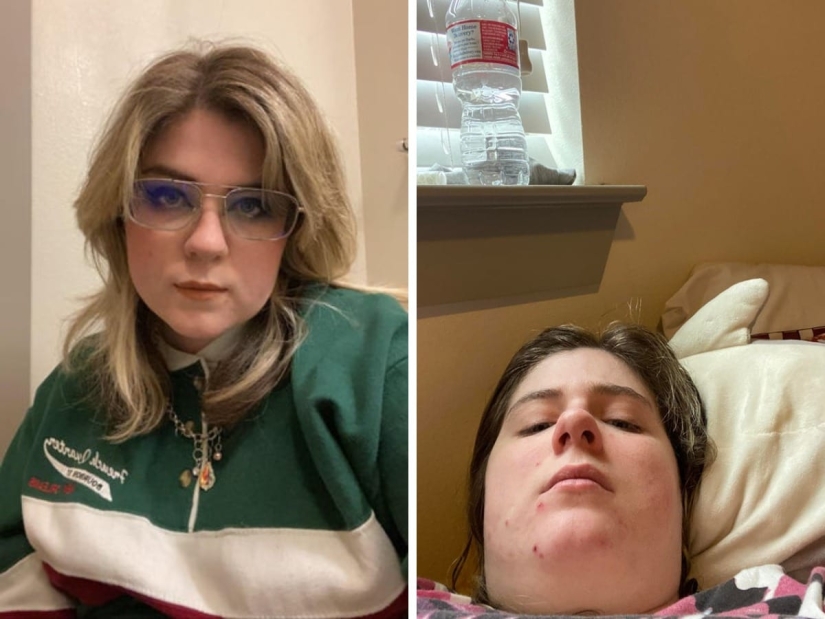 La Bella y la Bestia: 22 chicas que no tienen miedo de ser imperfectas La Bella y la Bestia: 22 chicas que no tienen miedo de ser imperfectas