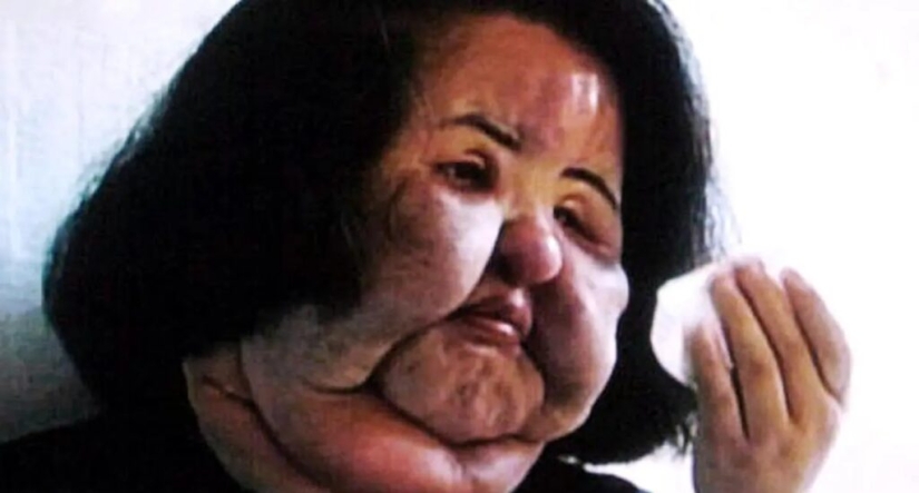 La historia de Hang Mioku, una mujer que, en busca de la belleza, se convirtió en un monstruo. La historia de Hang Mioku, una mujer que, en busca de la belleza, se convirtió en un monstruo.