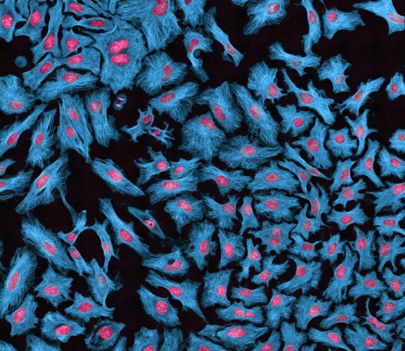 La historia de Henrietta Lacks, la mujer que revolucionó la ciencia mundial después de su muerte La historia de Henrietta Lacks, la mujer que revolucionó la ciencia mundial después de su muerte