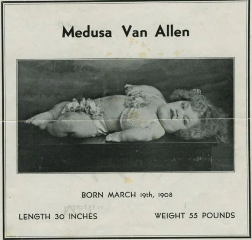 La historia de la artista de circo inmóvil Medusa Van Allen, apodada "Pequeña Miss Sunshine" La historia de la artista de circo inmóvil Medusa Van Allen, apodada "Pequeña Miss Sunshine"