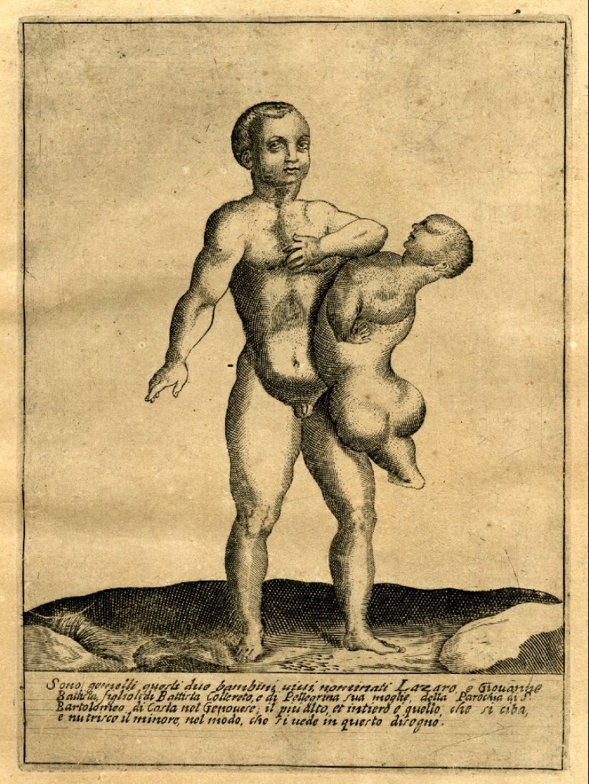 La historia de los gemelos siameses Colloredo, que lograron convertirse en mosqueteros del rey de Francia