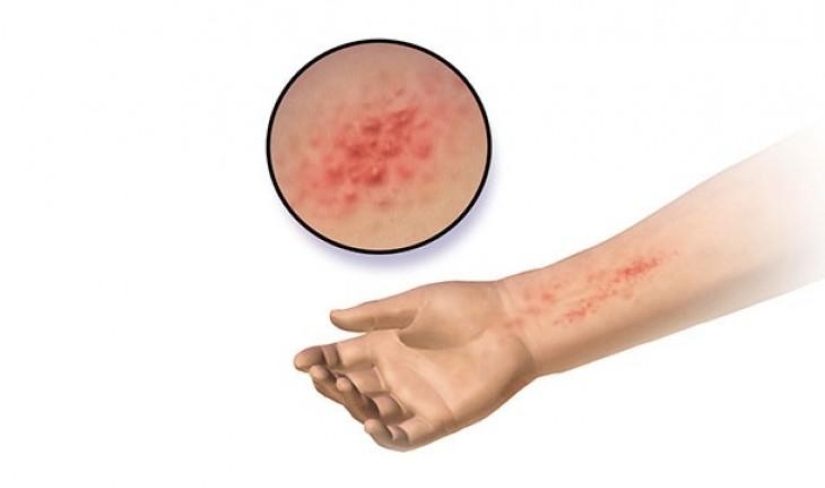 Las 10 Formas Más Fáciles de Morir que Te Harán Apreciar la Vida Las 10 Formas Más Fáciles de Morir que Te Harán Apreciar la Vida