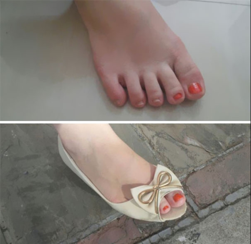 Los 22 ejemplos más impresionantes de pereza crónica Los 22 ejemplos más impresionantes de pereza crónica