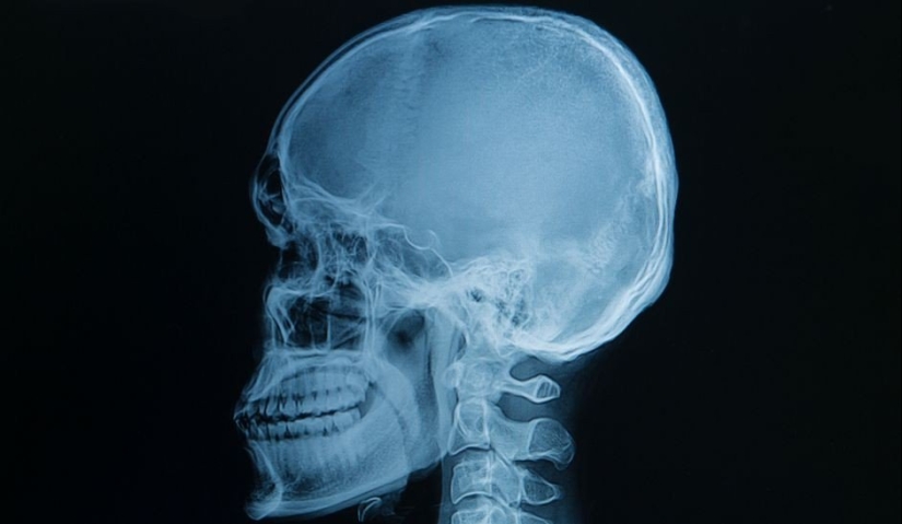 Mejor que cualquier libro de texto: más de 20 imágenes sobre anatomía humana que te sorprenderán Mejor que cualquier libro de texto: más de 20 imágenes sobre anatomía humana que te sorprenderán