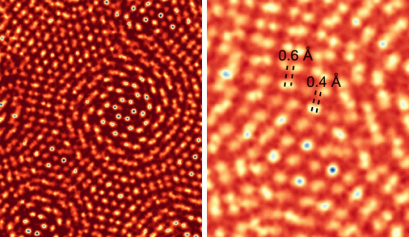 Mejor que cualquier libro de texto: más de 20 imágenes sobre anatomía humana que te sorprenderán Mejor que cualquier libro de texto: más de 20 imágenes sobre anatomía humana que te sorprenderán