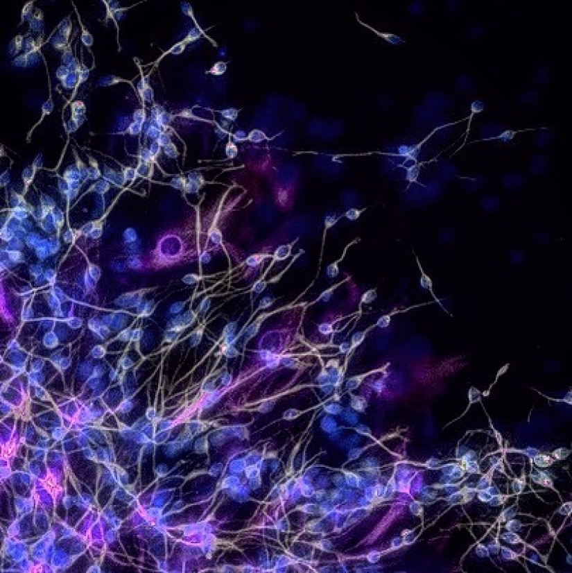 Mejor que cualquier libro de texto: más de 20 imágenes sobre anatomía humana que te sorprenderán Mejor que cualquier libro de texto: más de 20 imágenes sobre anatomía humana que te sorprenderán