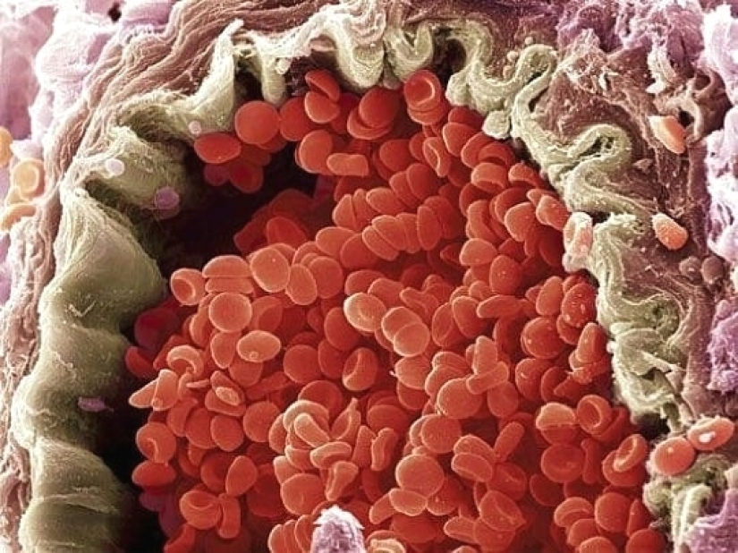 Mejor que cualquier libro de texto: más de 20 imágenes sobre anatomía humana que te sorprenderán Mejor que cualquier libro de texto: más de 20 imágenes sobre anatomía humana que te sorprenderán