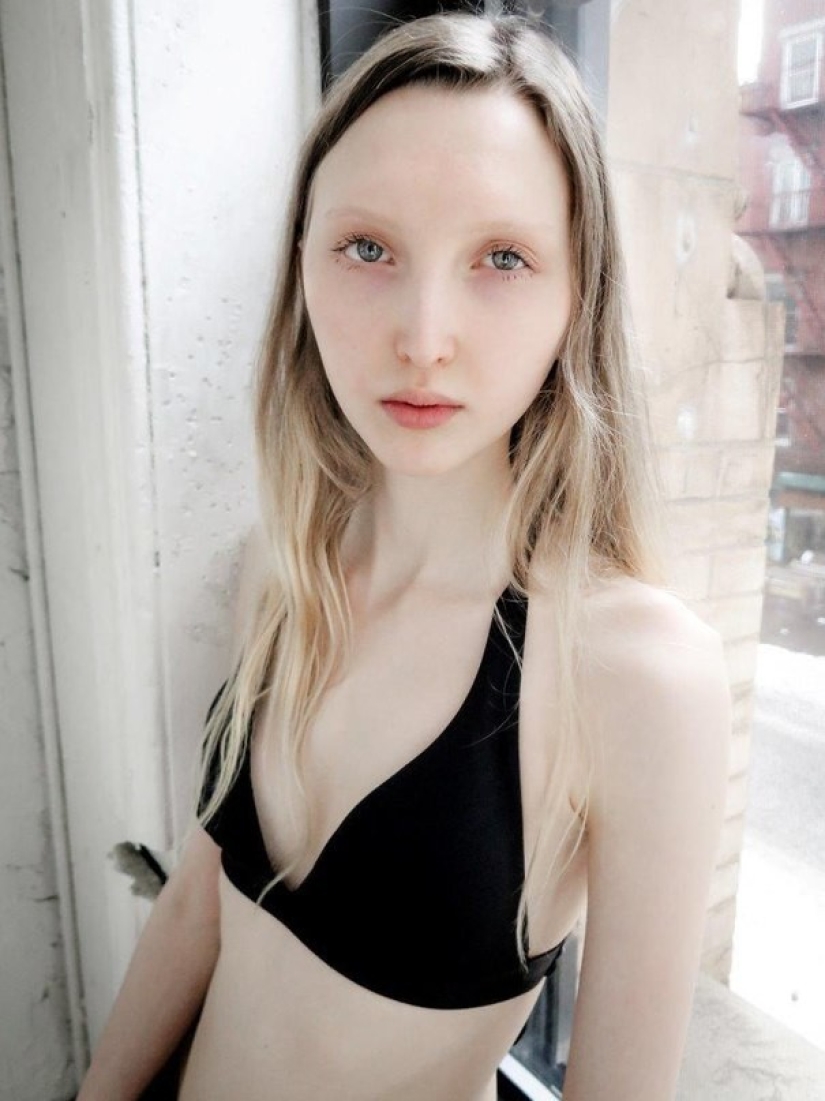 Models with defects in appearance: ugliness or a highlight? Models with defects in appearance: ugliness or a highlight?