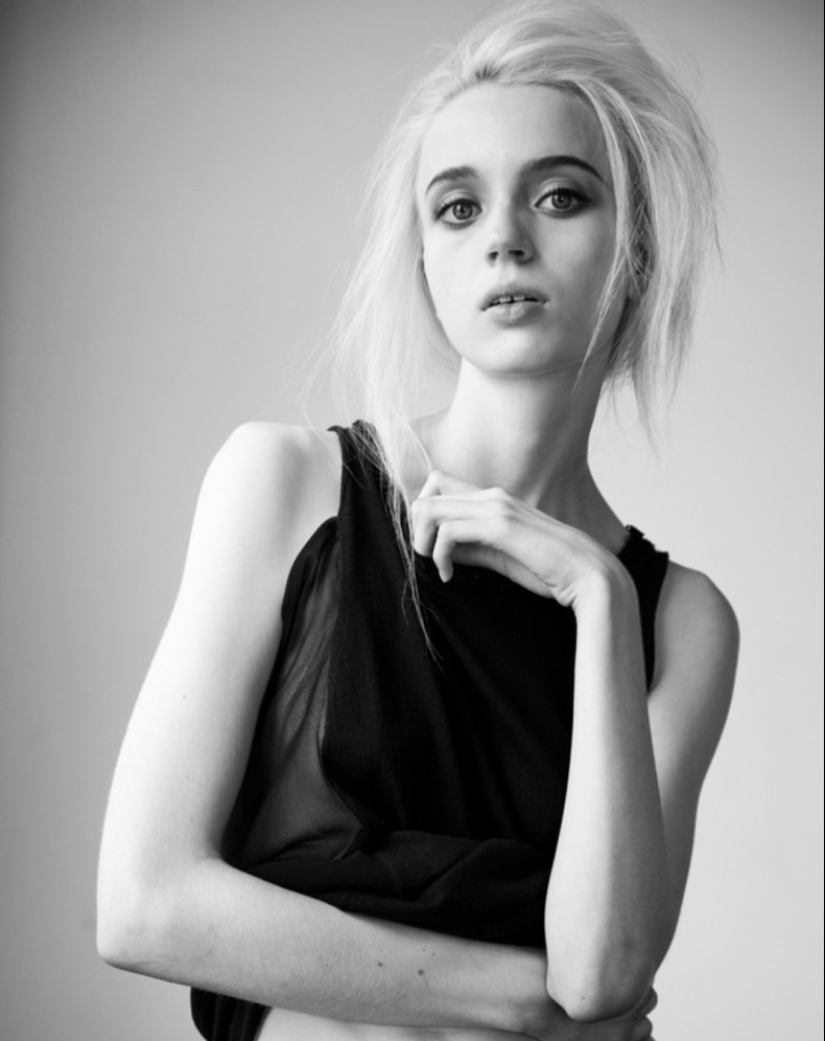 Models with defects in appearance: ugliness or a highlight? Models with defects in appearance: ugliness or a highlight?